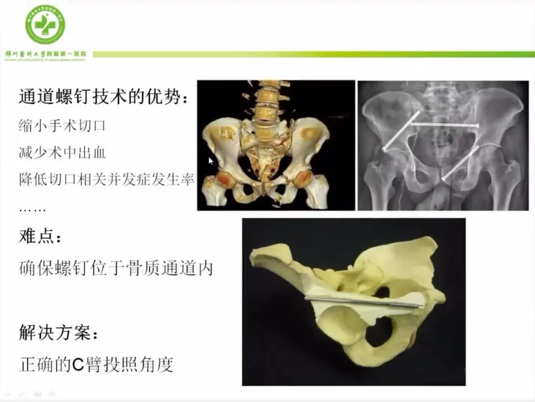 聚焦顯微外科|葫蘆島市醫(yī)學會顯微外科學分會第一屆第二次學術會議順利召開(圖11)